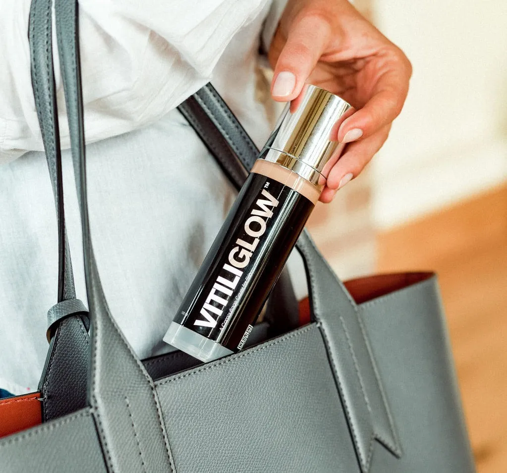 Vitiliglow product